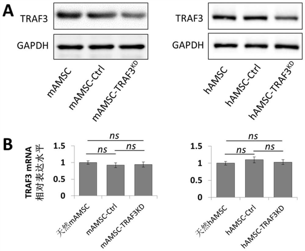 Anti-aging modification method of adipose-derived mesenchymal stem cells and application of anti-aging modification method