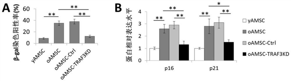 Anti-aging modification method of adipose-derived mesenchymal stem cells and application of anti-aging modification method