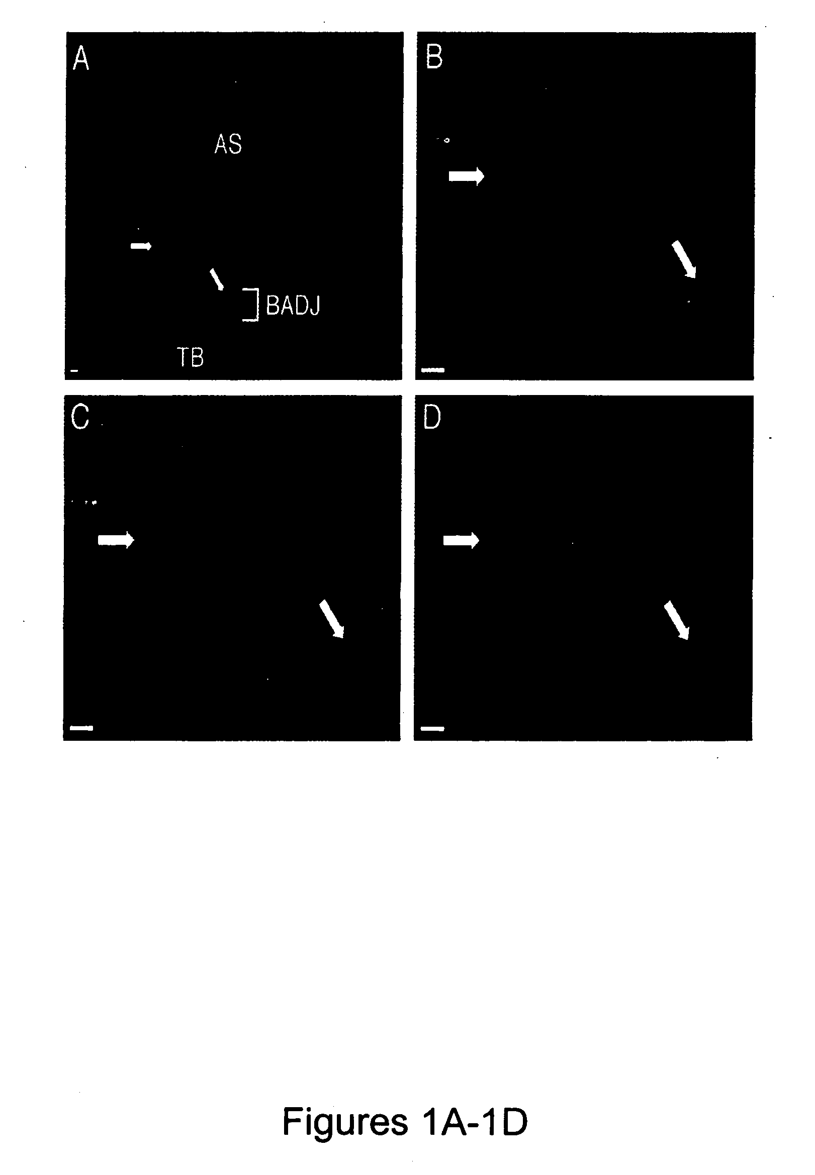 Bronchioalveolar stem cells and uses thereof