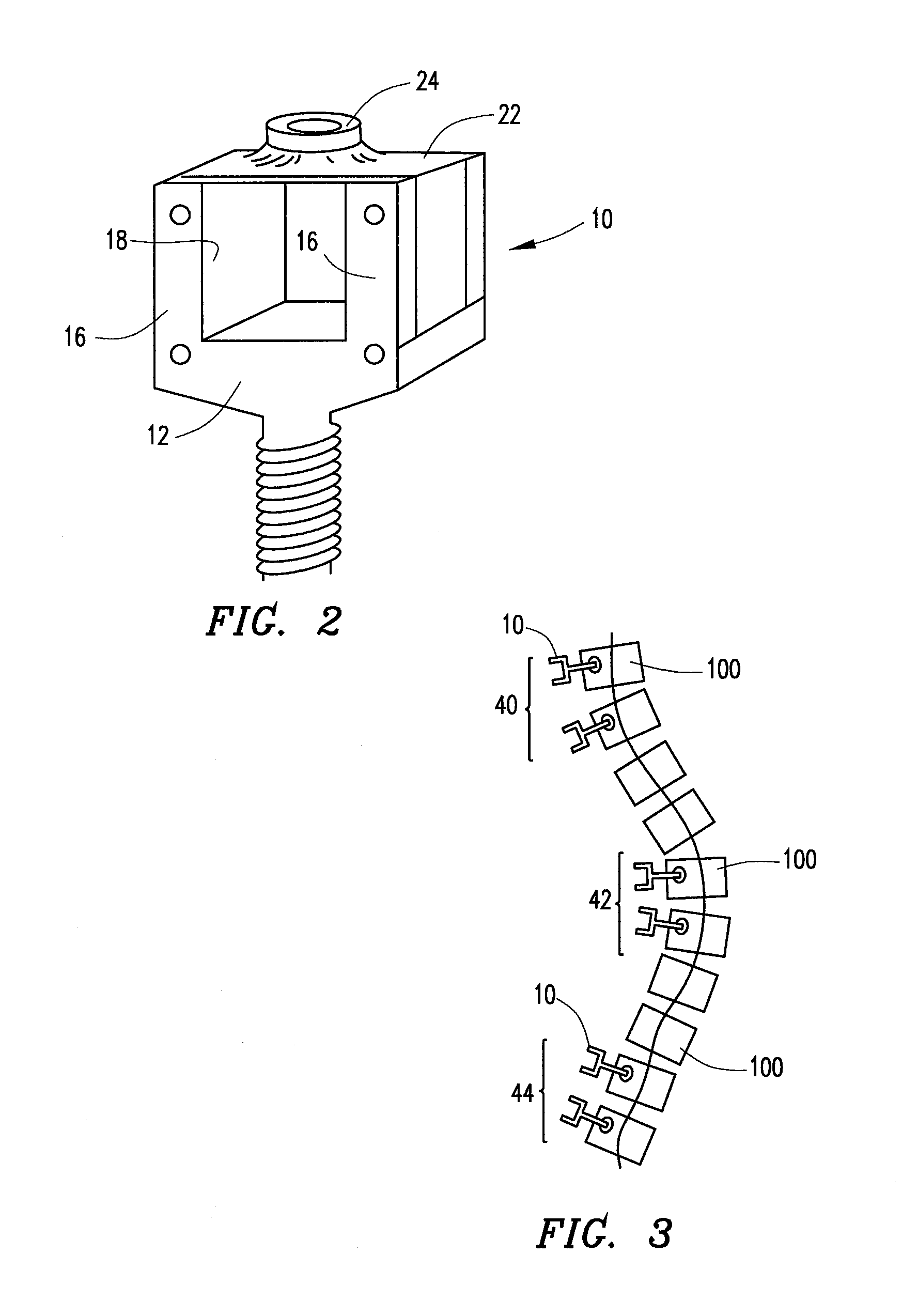 System and method for aligning vertebrae in the amelioration of aberrant spinal column deviation conditions in patients requiring the accomodation of spinal column growth or elongation