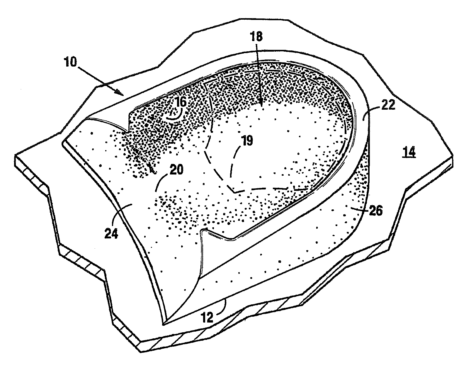 Lateral Support Craniocervical Orthosis and Method