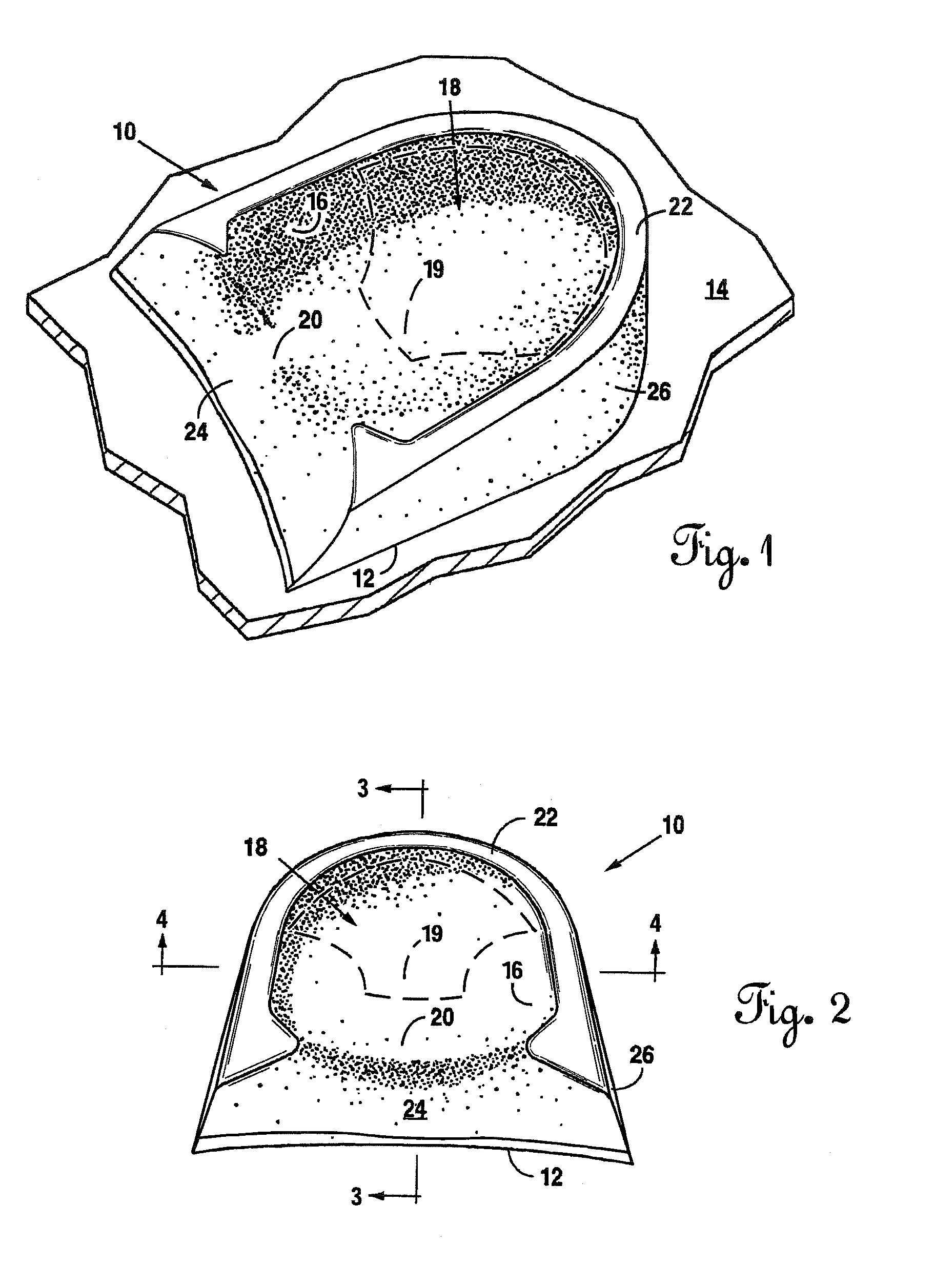 Lateral Support Craniocervical Orthosis and Method