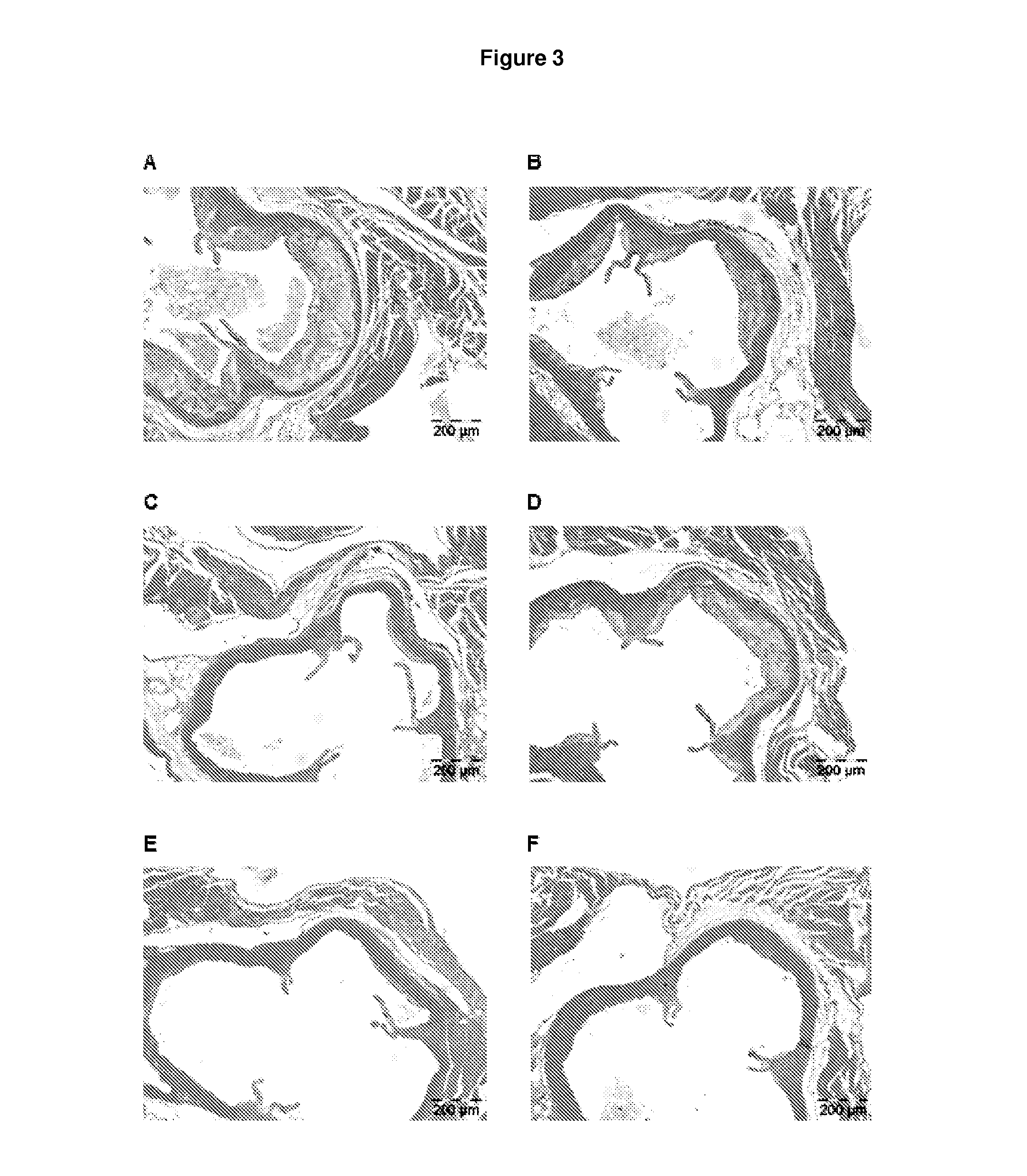 Methods for inhibiting atherosclerosis by administering an inhibitor of pcsk9