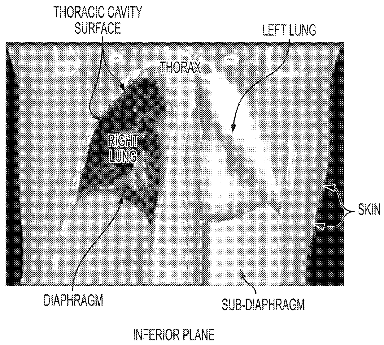 System and method for prediction of respiratory motion from 3D thoracic images