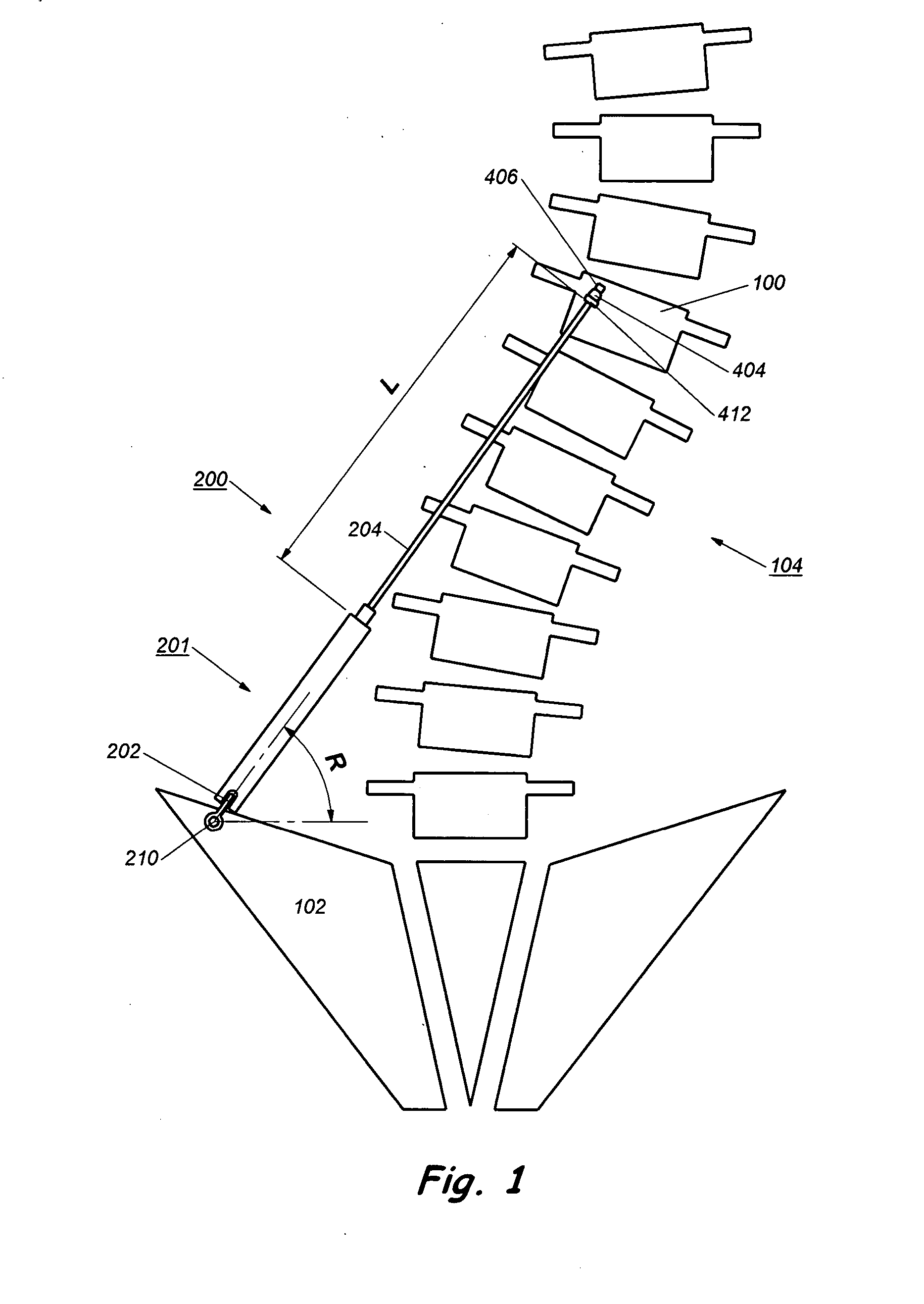 Device and method for treatment of spinal deformity