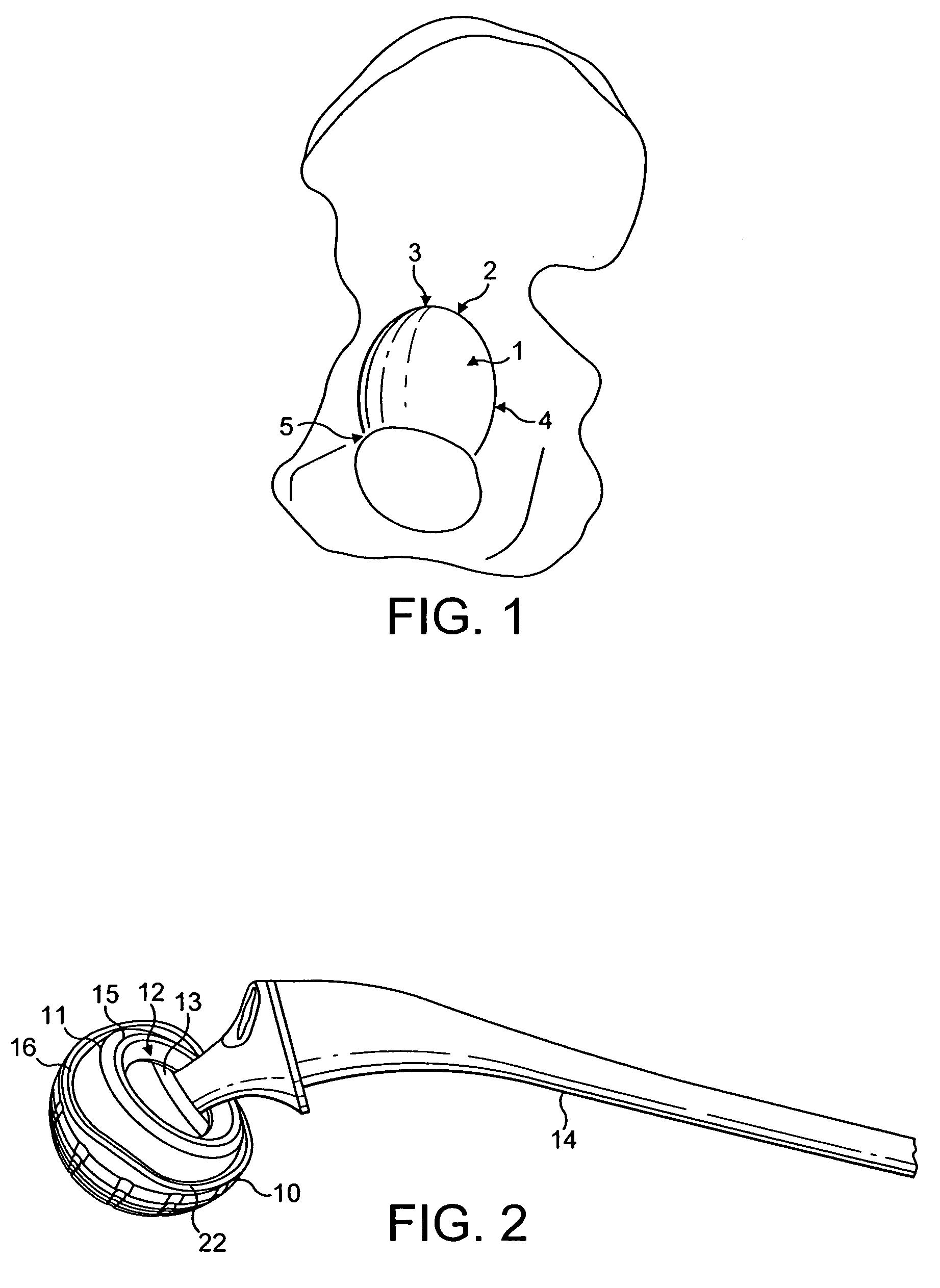 Prosthetic acetabular cup and prosthetic femoral joint incorporating such a cup