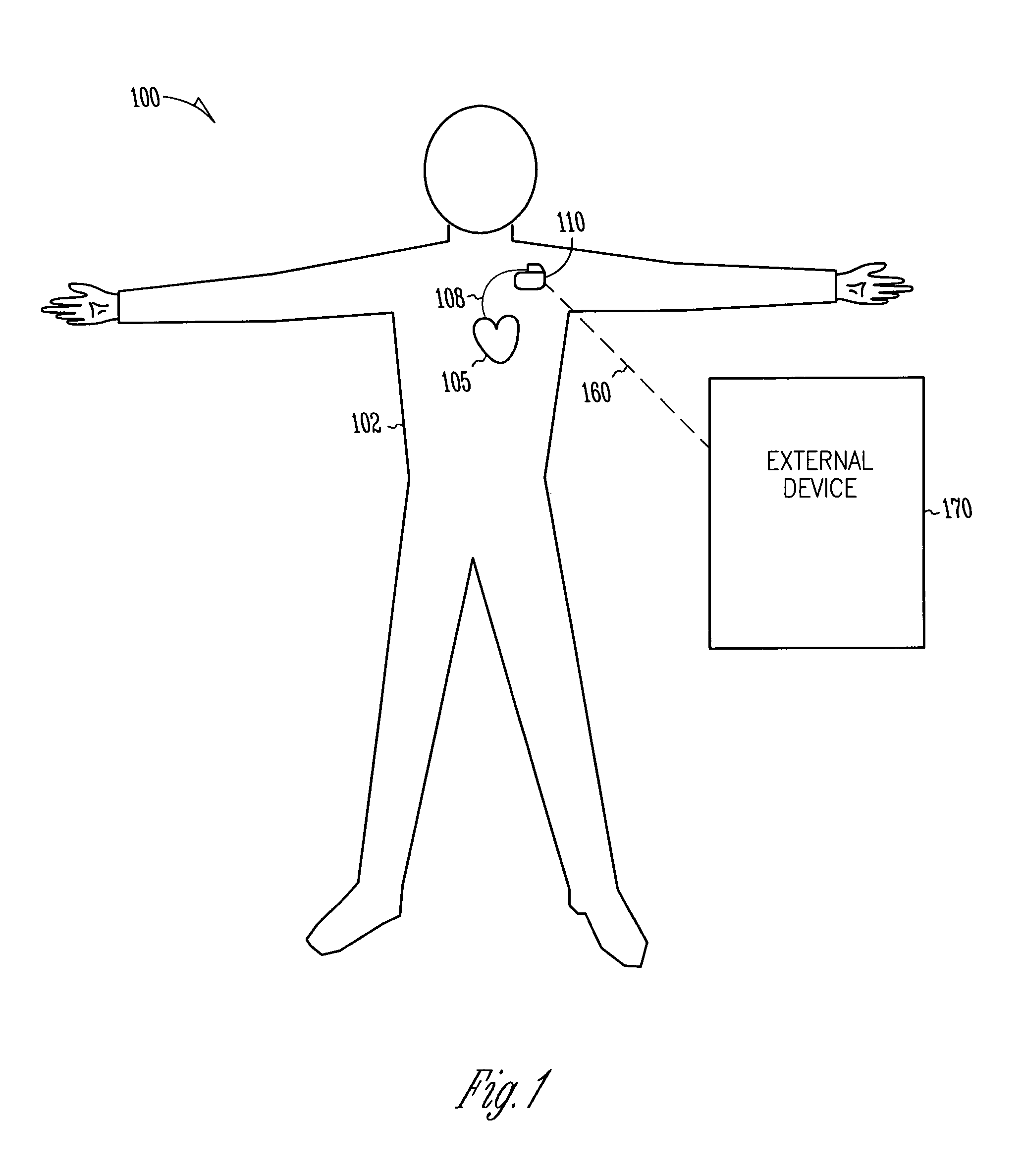 Adaptive software configuration for a medical device