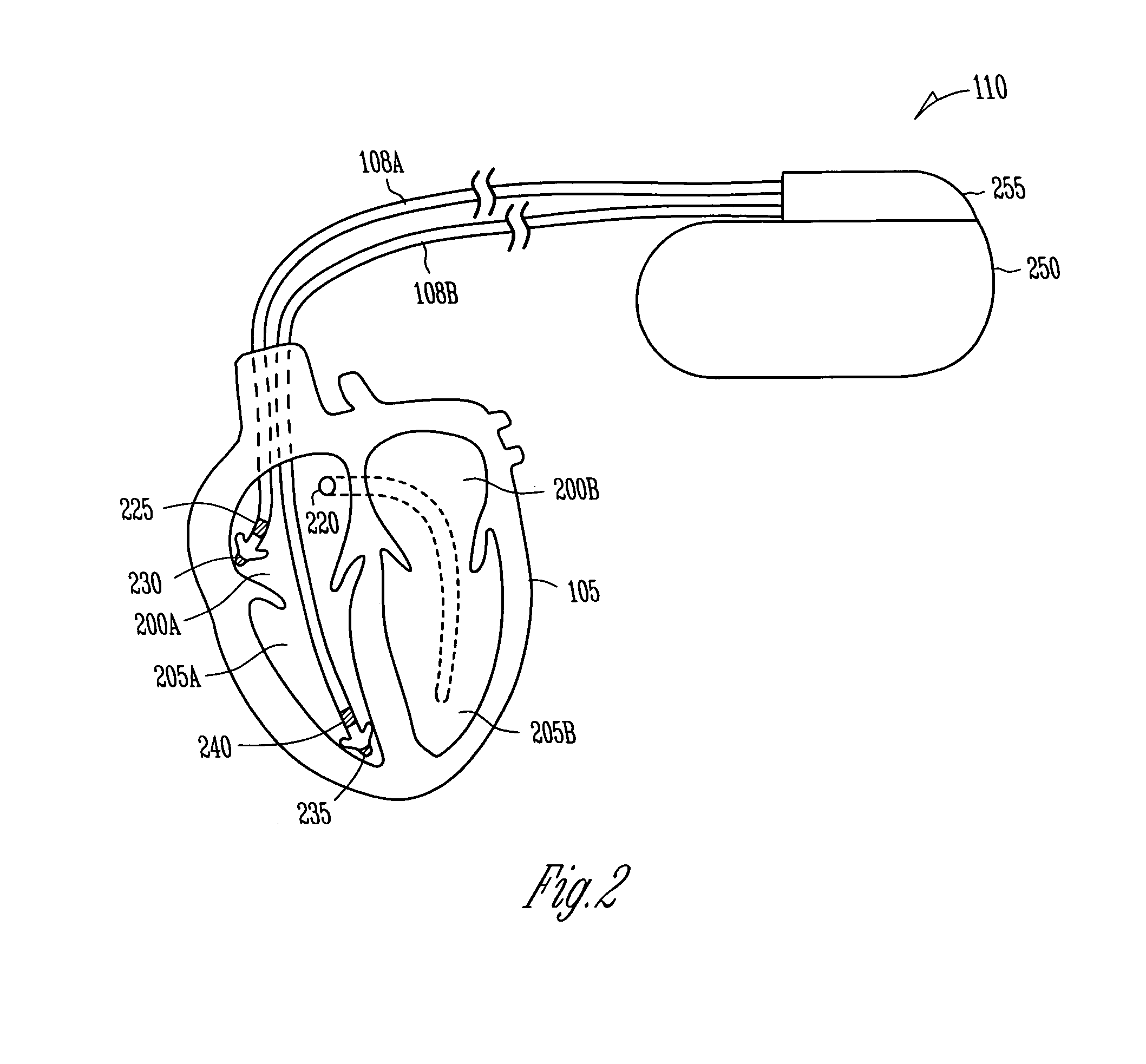 Adaptive software configuration for a medical device