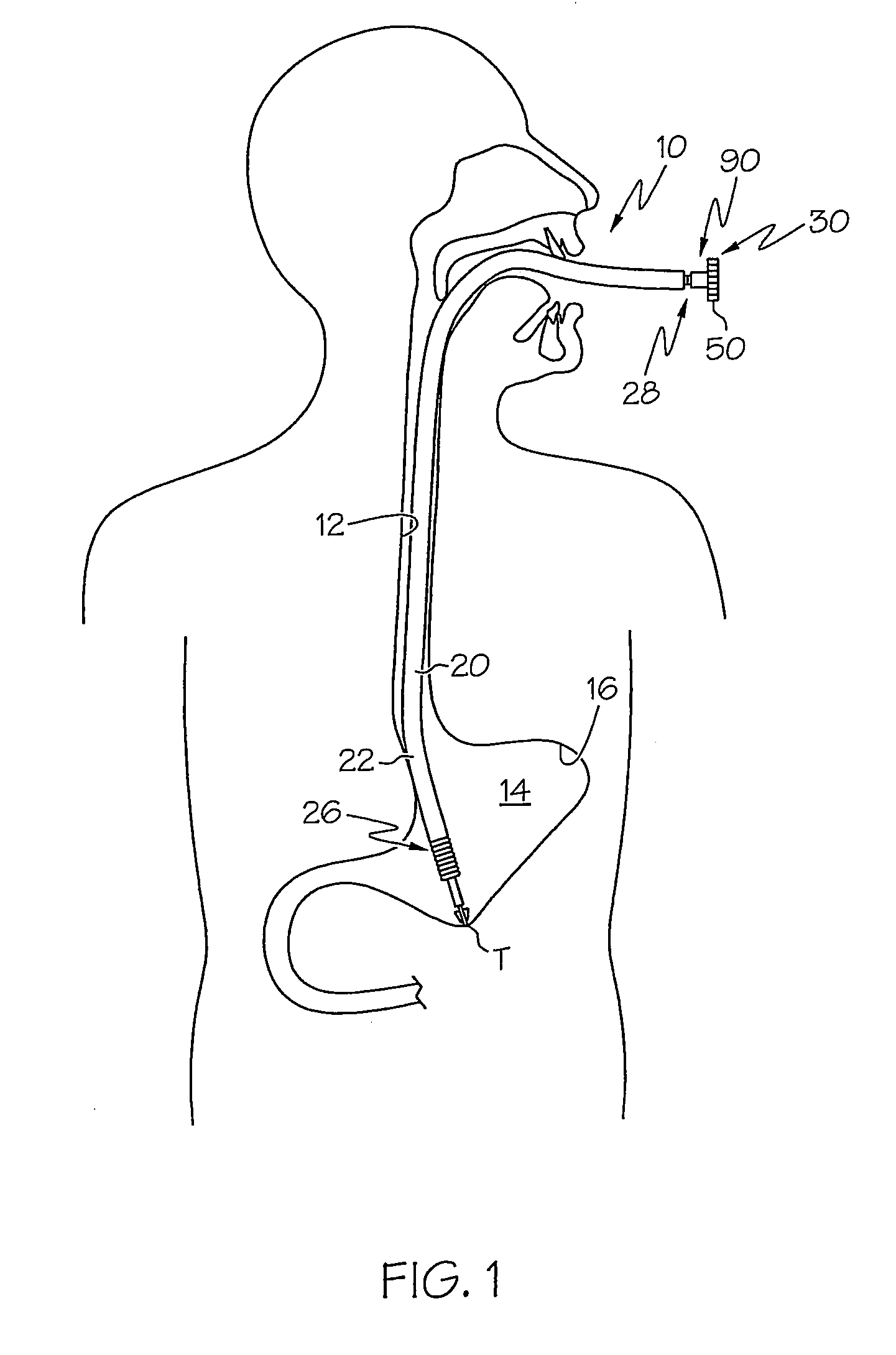 Flexible tissue-penetration instrument with blunt tip assembly and methods for penetrating tissue