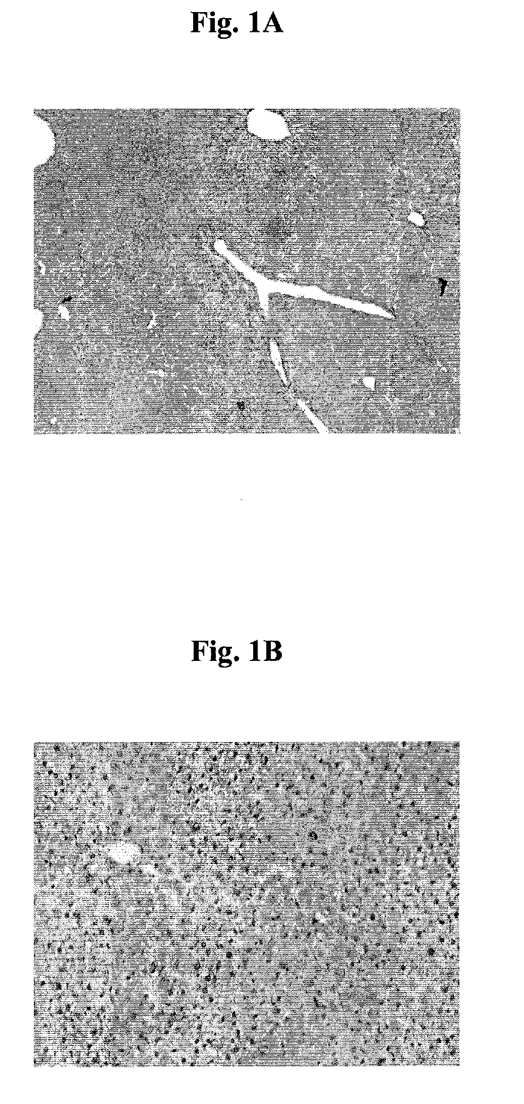 Compositions and methods for the treatment of disease