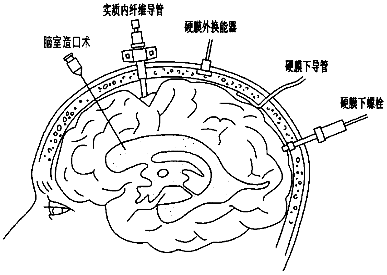 Intracranial pressure measuring device