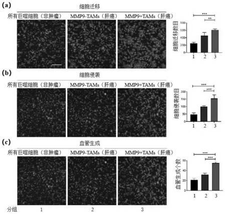 Application of PPAR[gamma] to influence liver cancer by promoting terminal differentiation of MMP9&lt;+&gt; tumor-associated macrophages