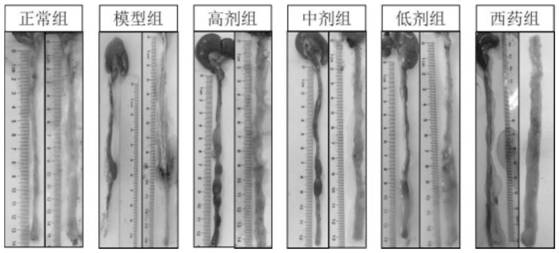 Chinese medicine composition for treating ulcerative colitis, Chinese medicine preparation and application thereof