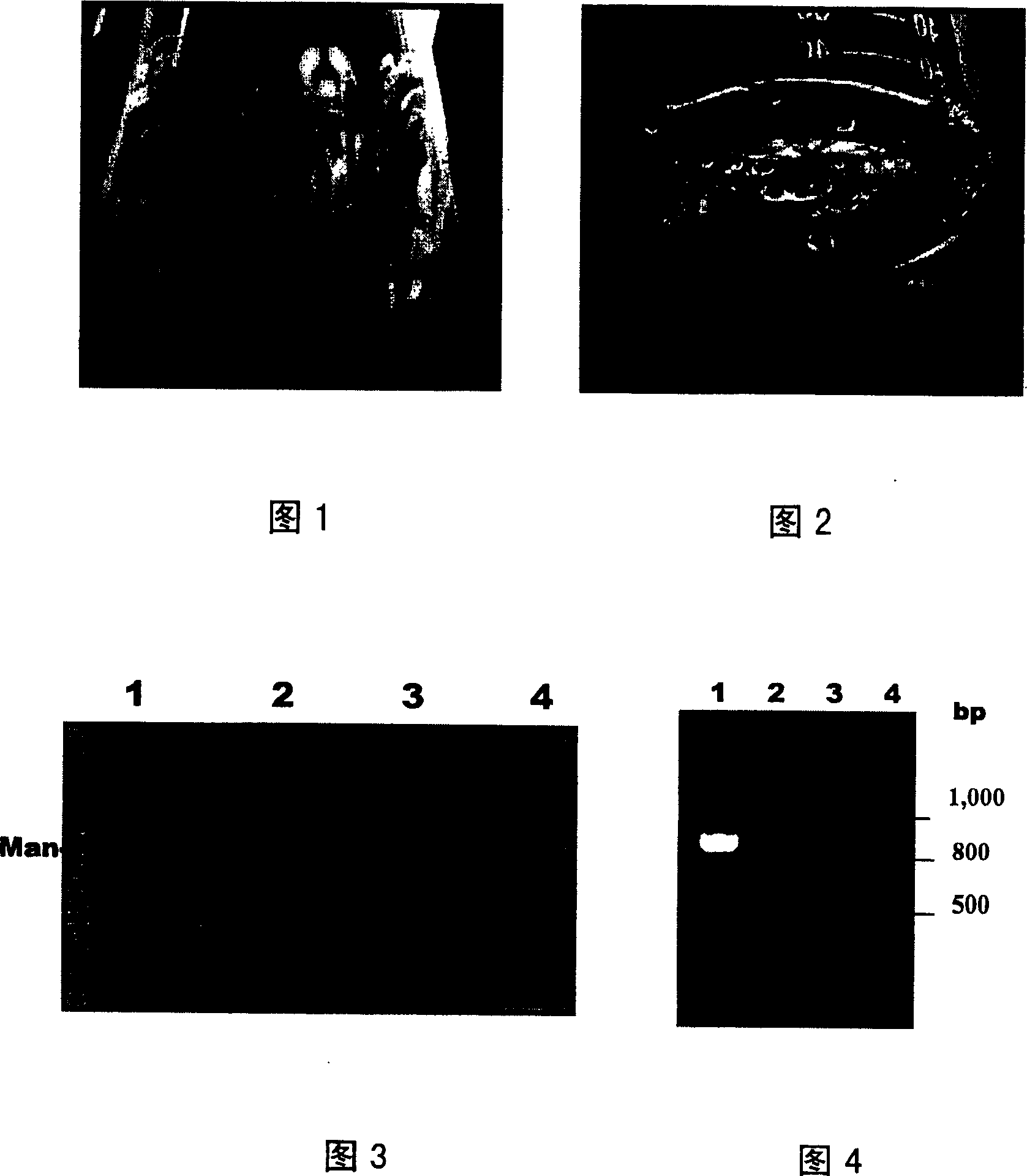 Method for culturing and producing cffeetive ingredients in polyose of saussurca hairy roots of saussurea medusa maxim