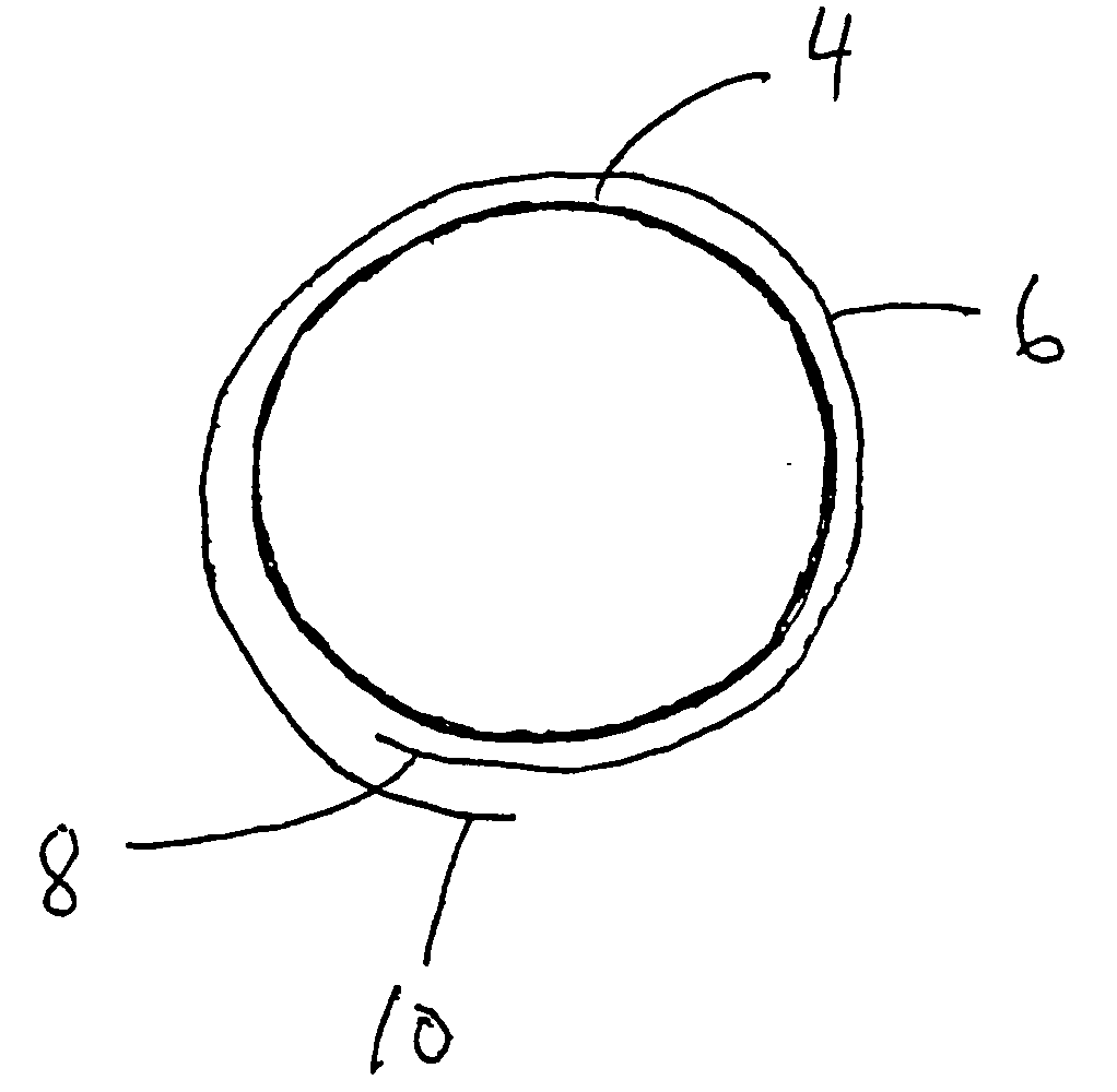 Stent assembly and device for application thereof