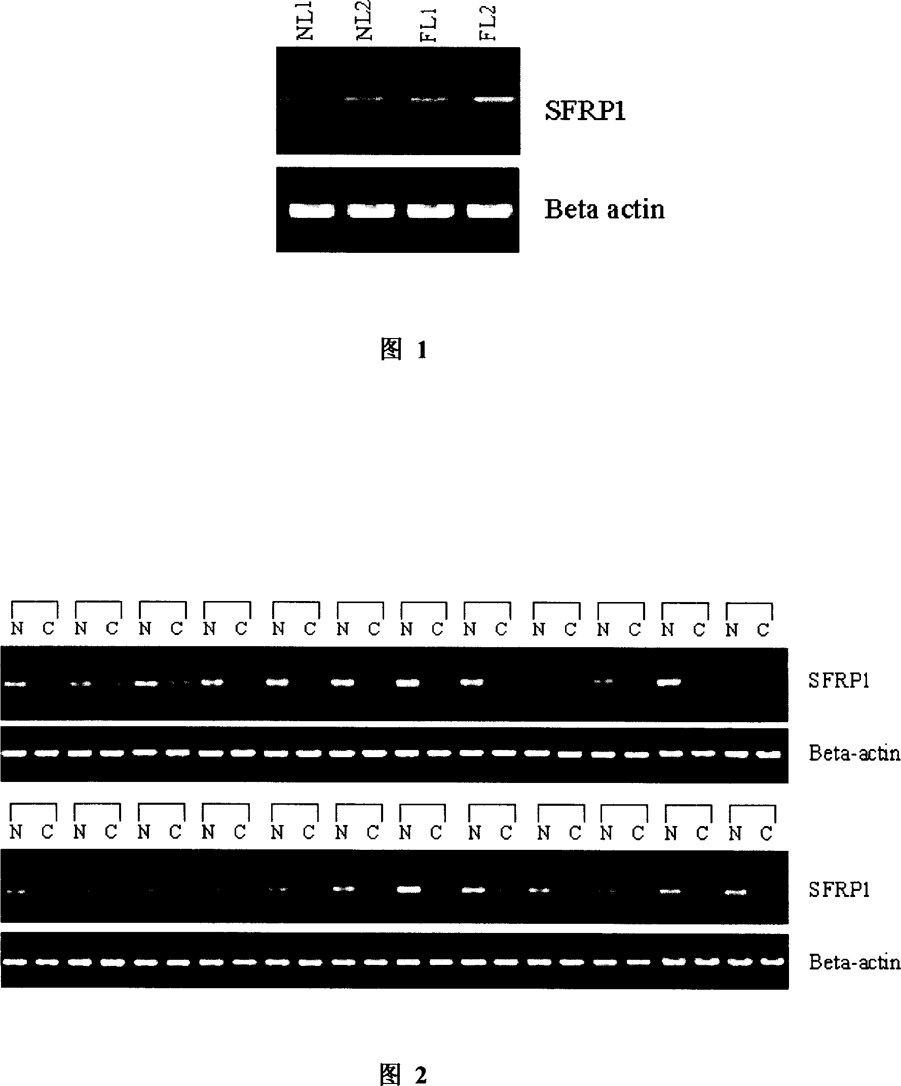 Human SFRP1 gene, its coded protein and application