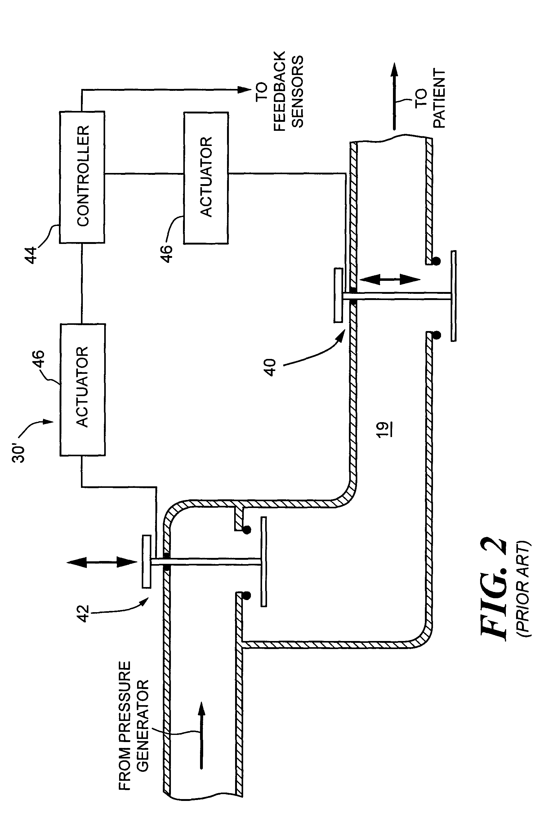 Pressure support system and method and a pressure control valve for use in such a system and method