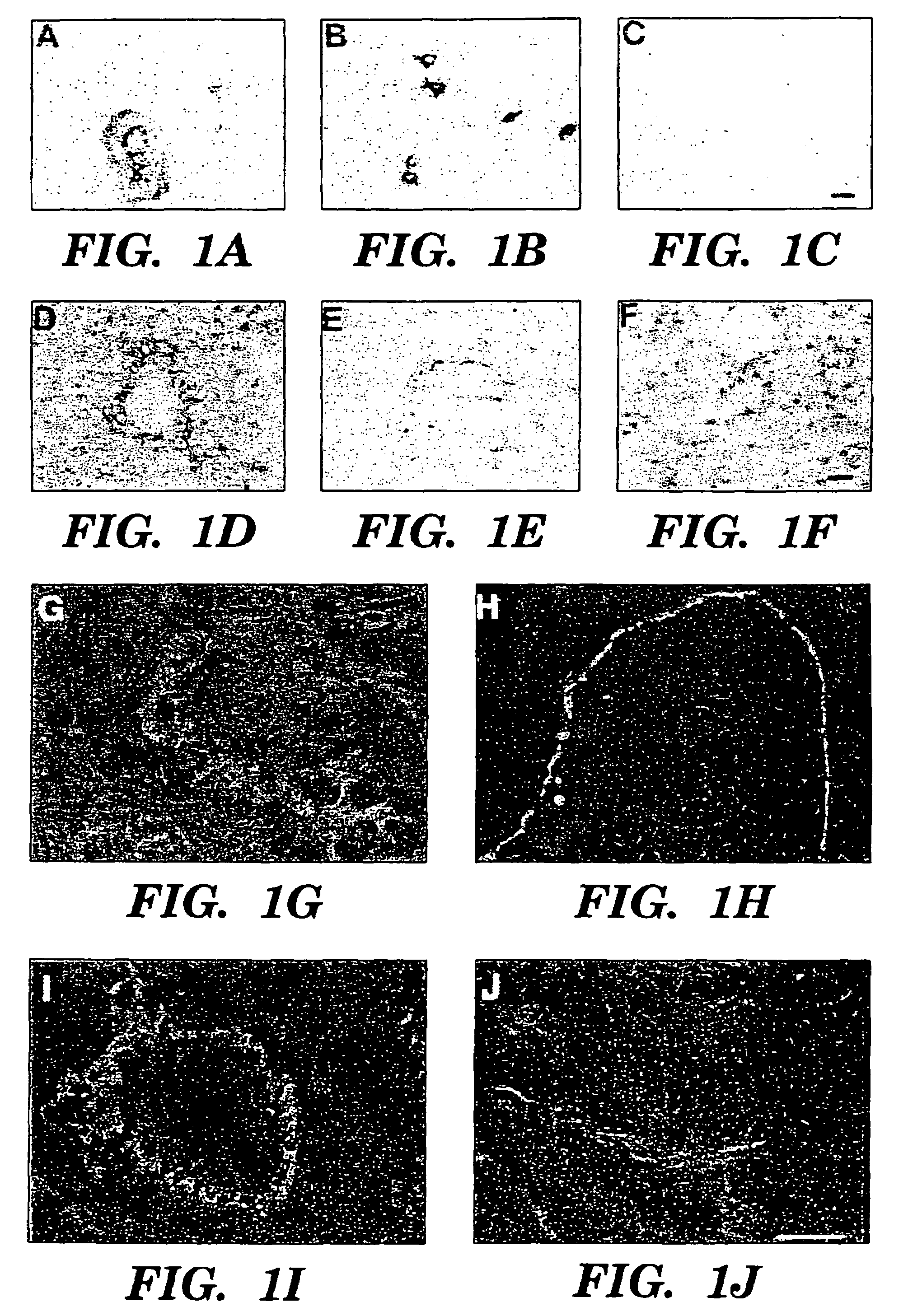 Methods for increasing capillary density and maintaining viability of microvascular cardiac endothelial cells using trk receptor ligands