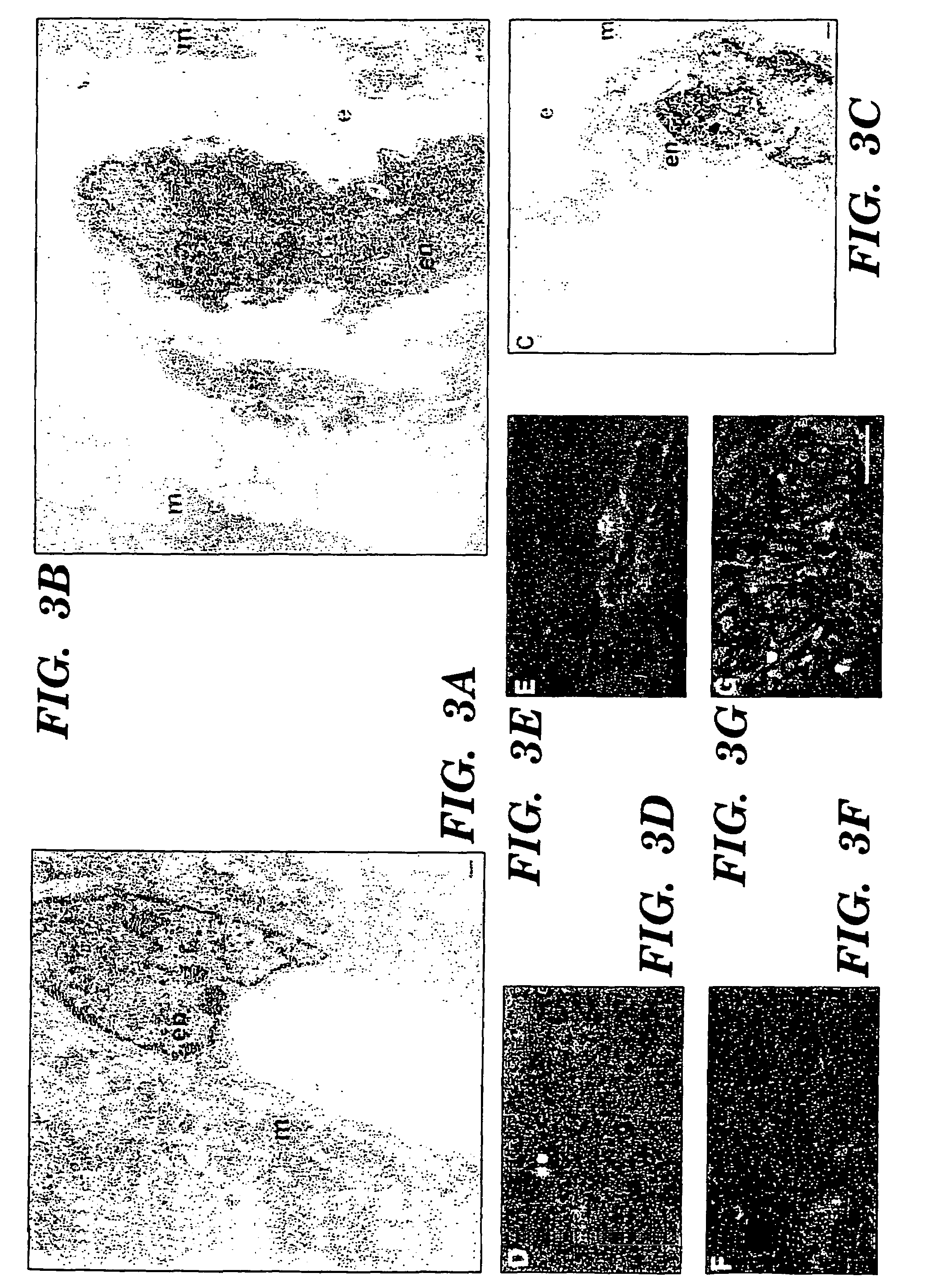 Methods for increasing capillary density and maintaining viability of microvascular cardiac endothelial cells using trk receptor ligands