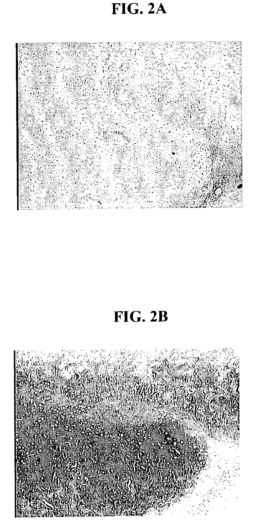 Biocompatible scaffold for ligament or tendon repair