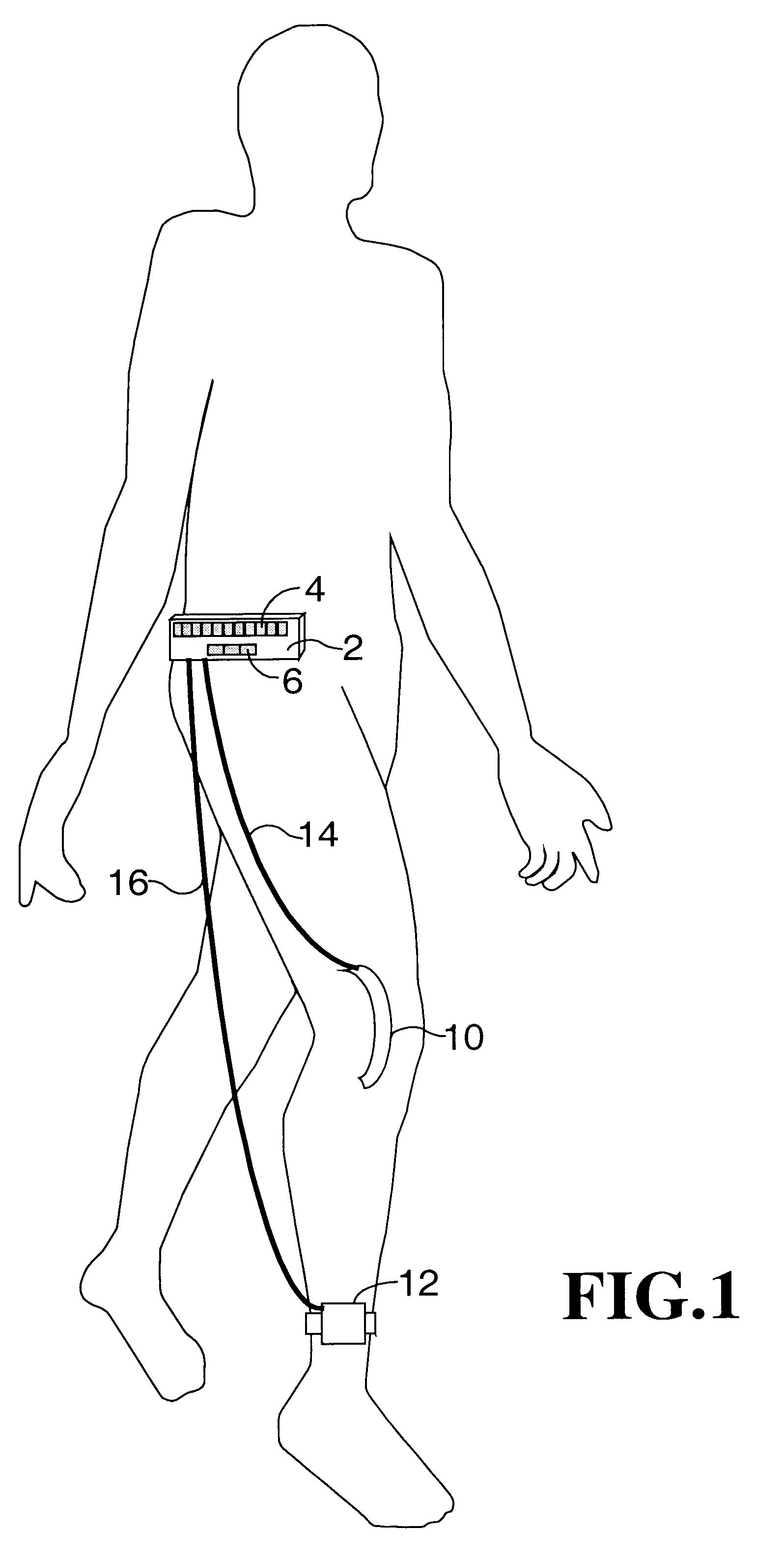 Apparatus and method for relating pain and activity of a patient
