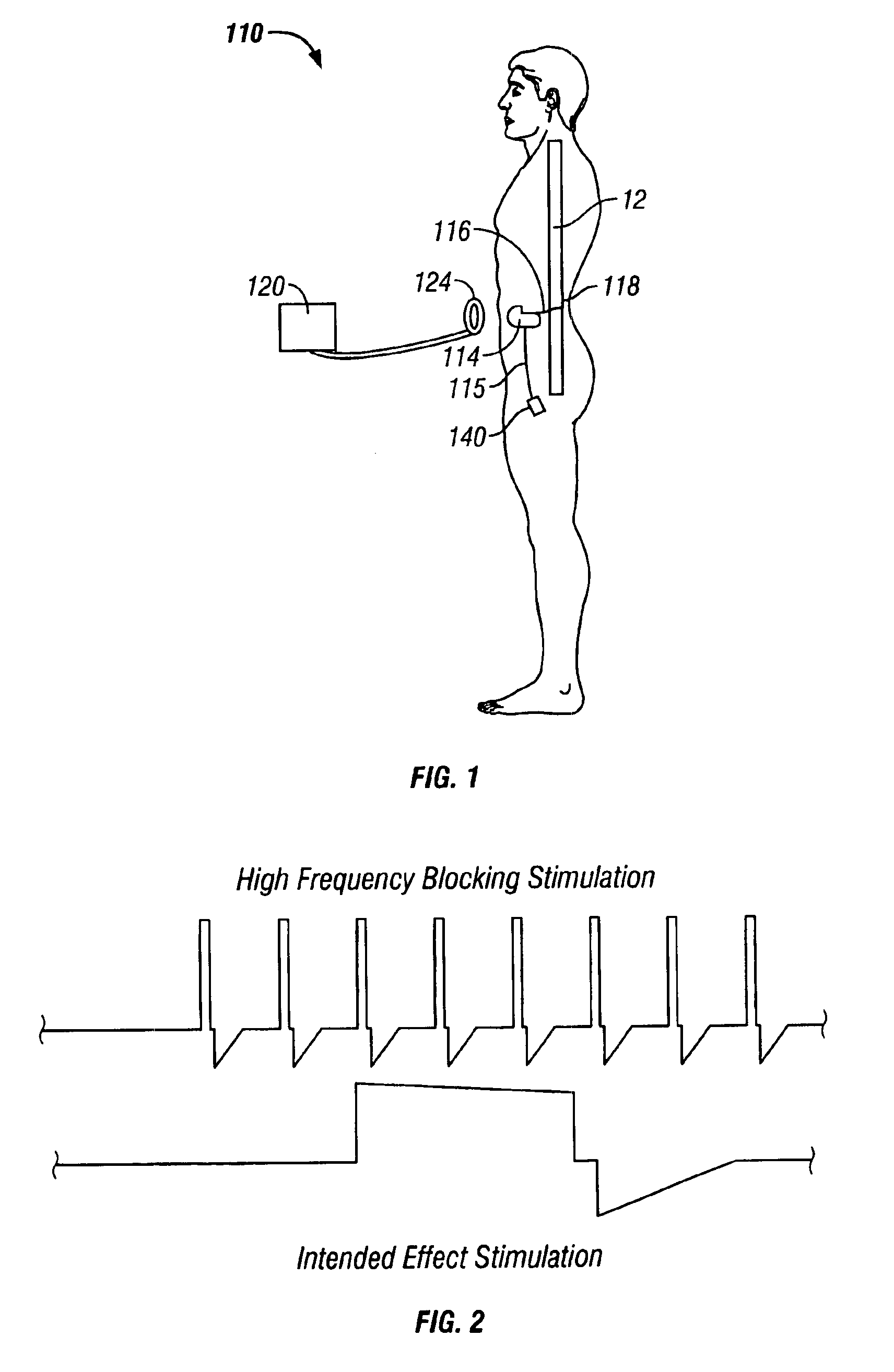 Apparatus for blocking activation of tissue or conduction of action potentials while other tissue is being therapeutically activated