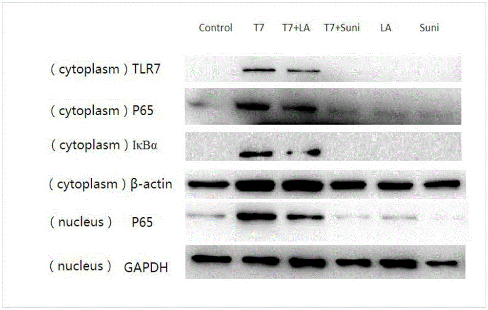 Application of combination of TLR7 agonist and tyrosine kinase inhibitor in preparing antineoplastic drugs