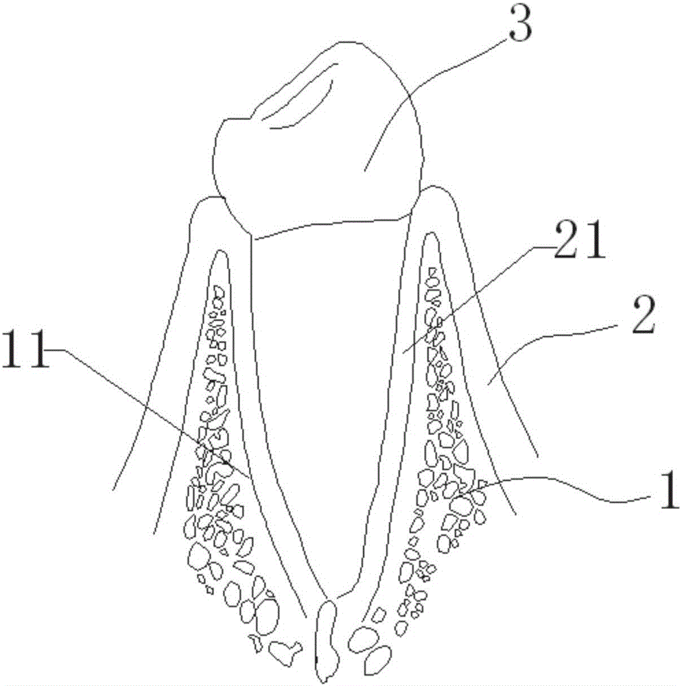 Oral medicine practice model formed through encapsulation injection molding and method thereof