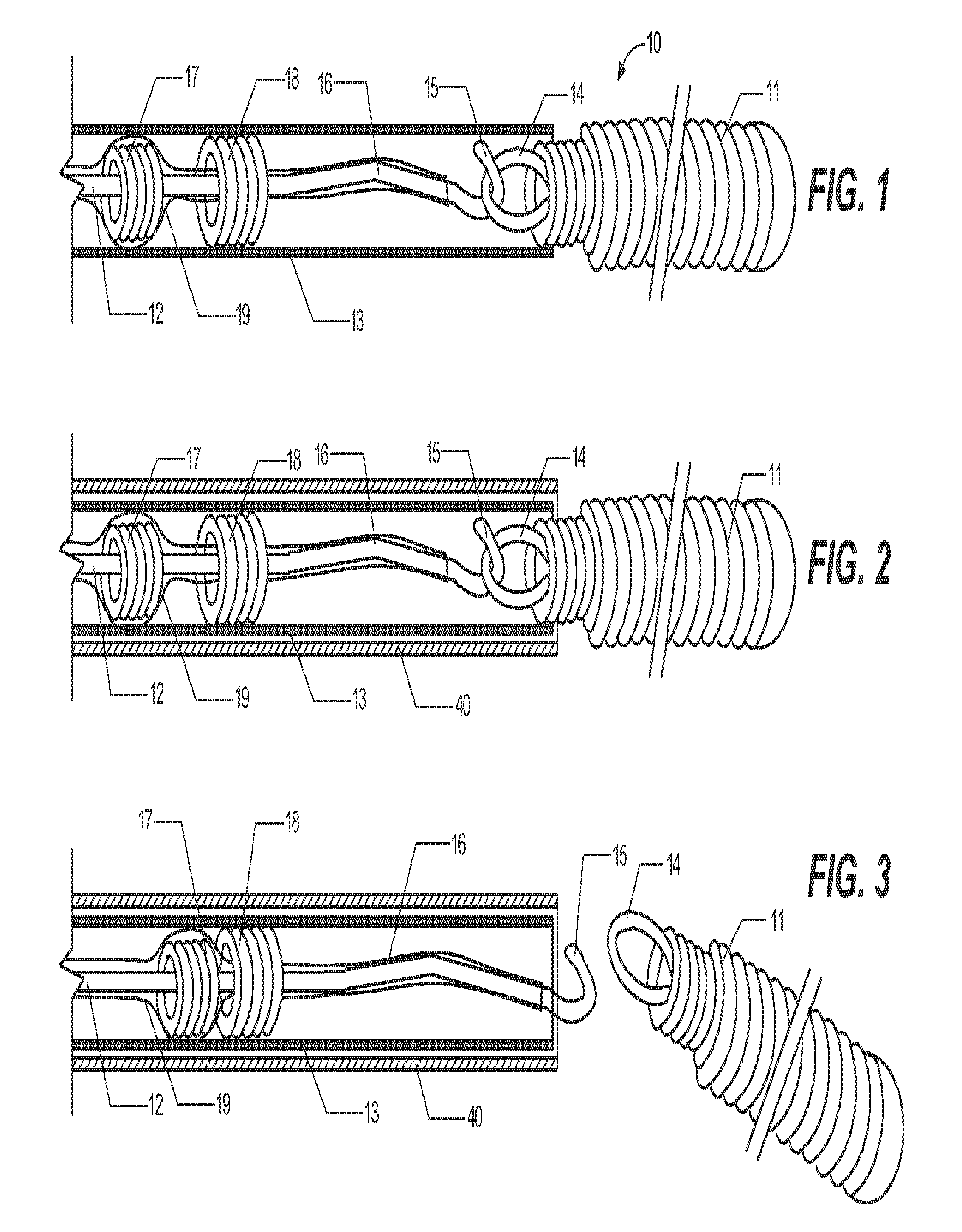 Delivery assembly for occlusion device using mechanical interlocking coupling mechanism