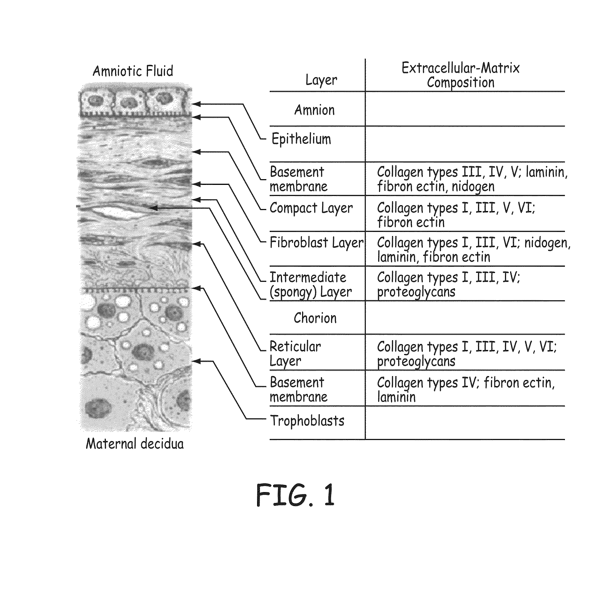 Stents modified with material comprising amnion tissue and corresponding processes