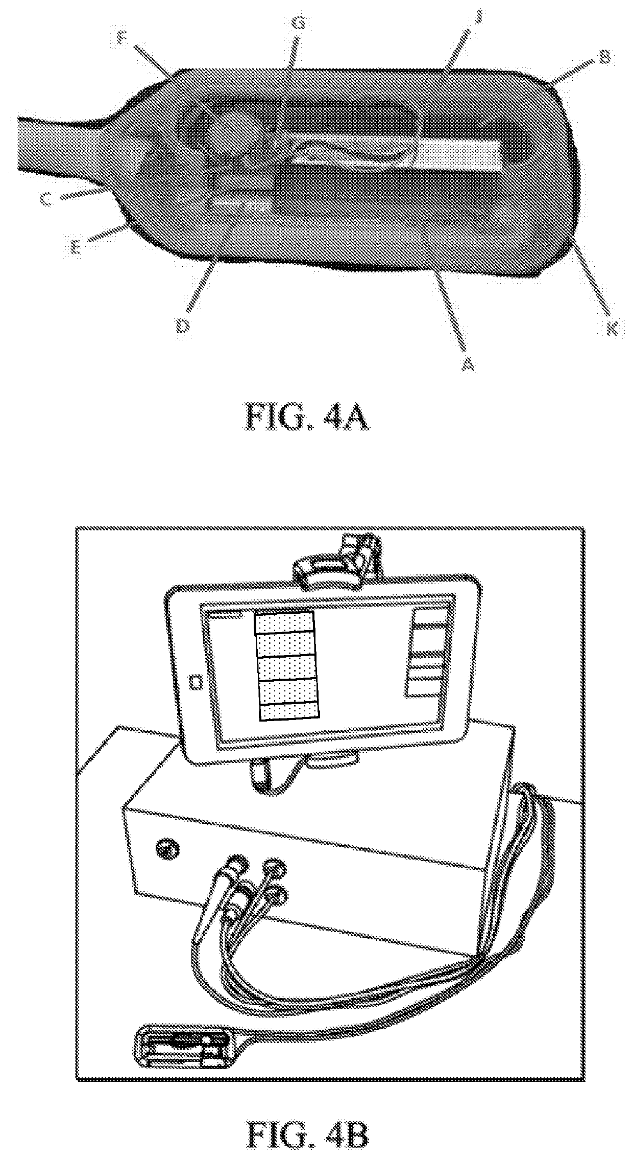 Automated ultrasound apparatus and methods to non-invasively monitor fluid responsiveness