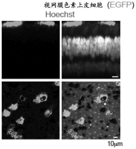 SynPIII, promoter for specific expression of genes in retinal pigment epithelium