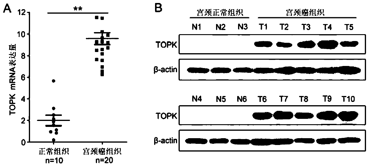 Application of T-LAK cell-originated protein kinase (TOPK) serving as cisplatin resistance therapy target for cervical cancer