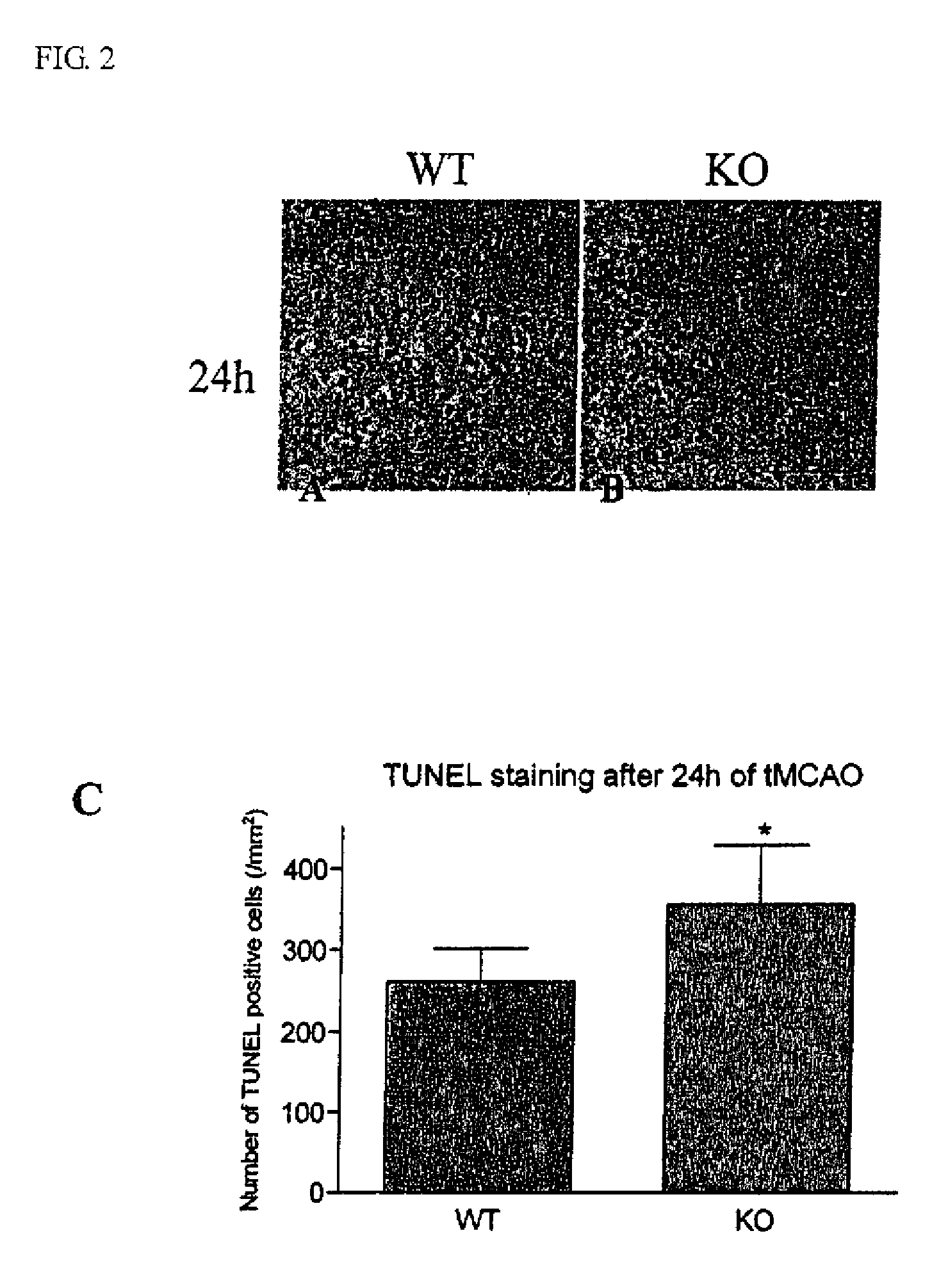Method of preventing and treating brain infarction