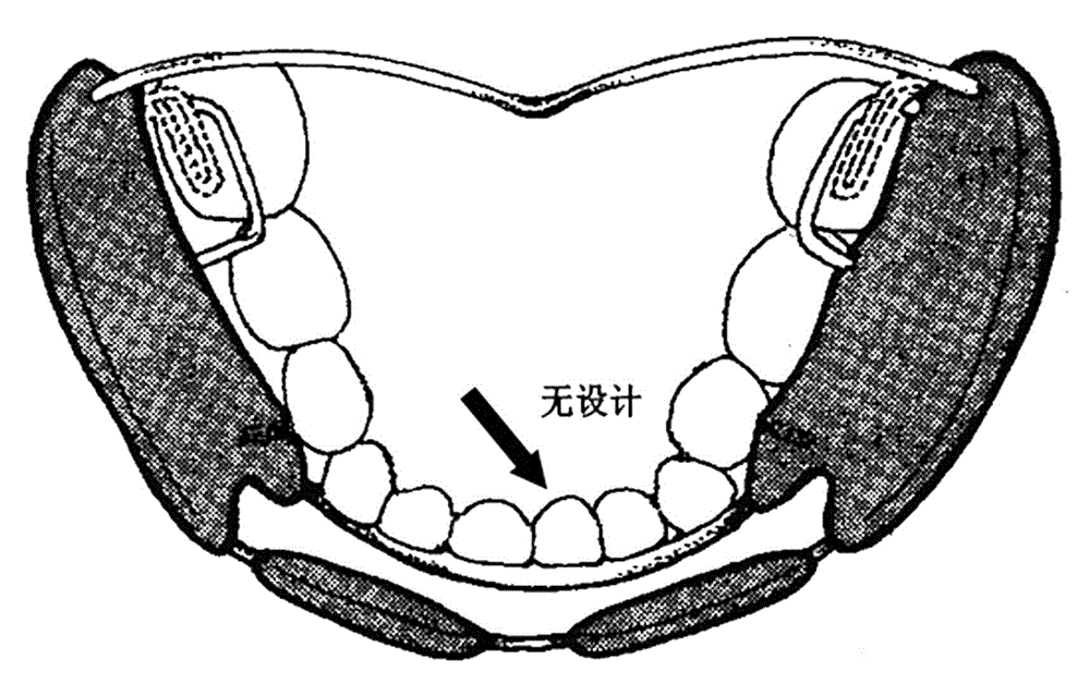 Functional regulator for mouth