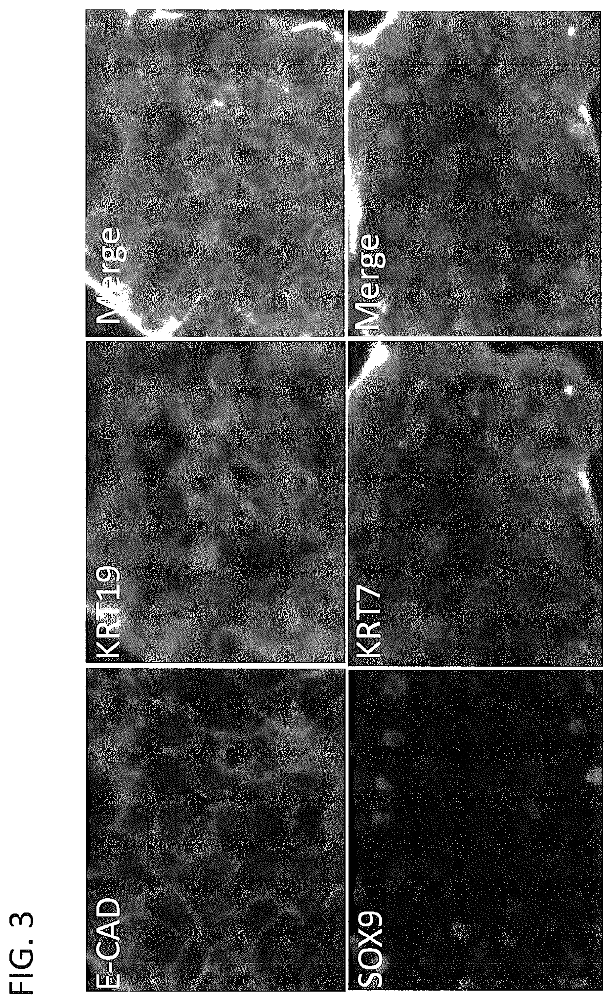 Derivation of hepatic stem cells and mature liver cell types and uses thereof