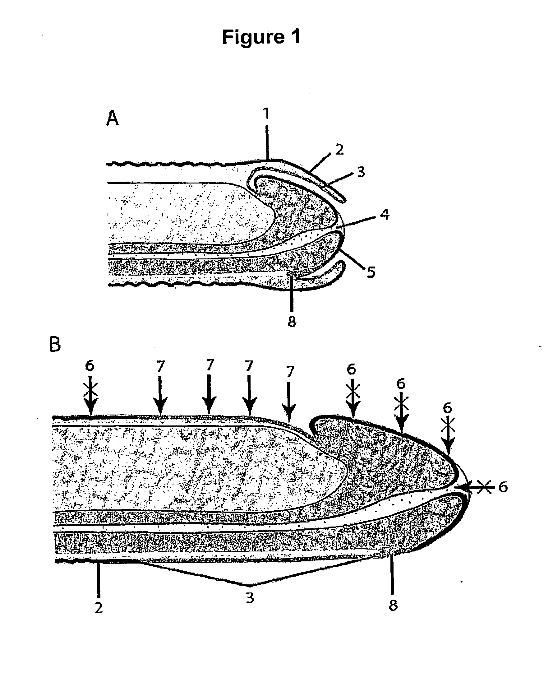 The Use of Oestrogen Applied to the Penis to Reduce HIV Infections