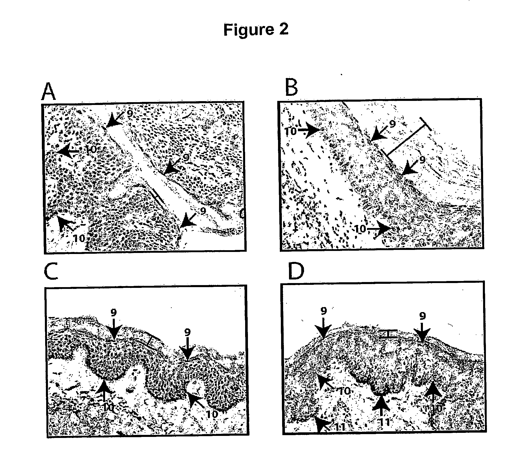 The Use of Oestrogen Applied to the Penis to Reduce HIV Infections