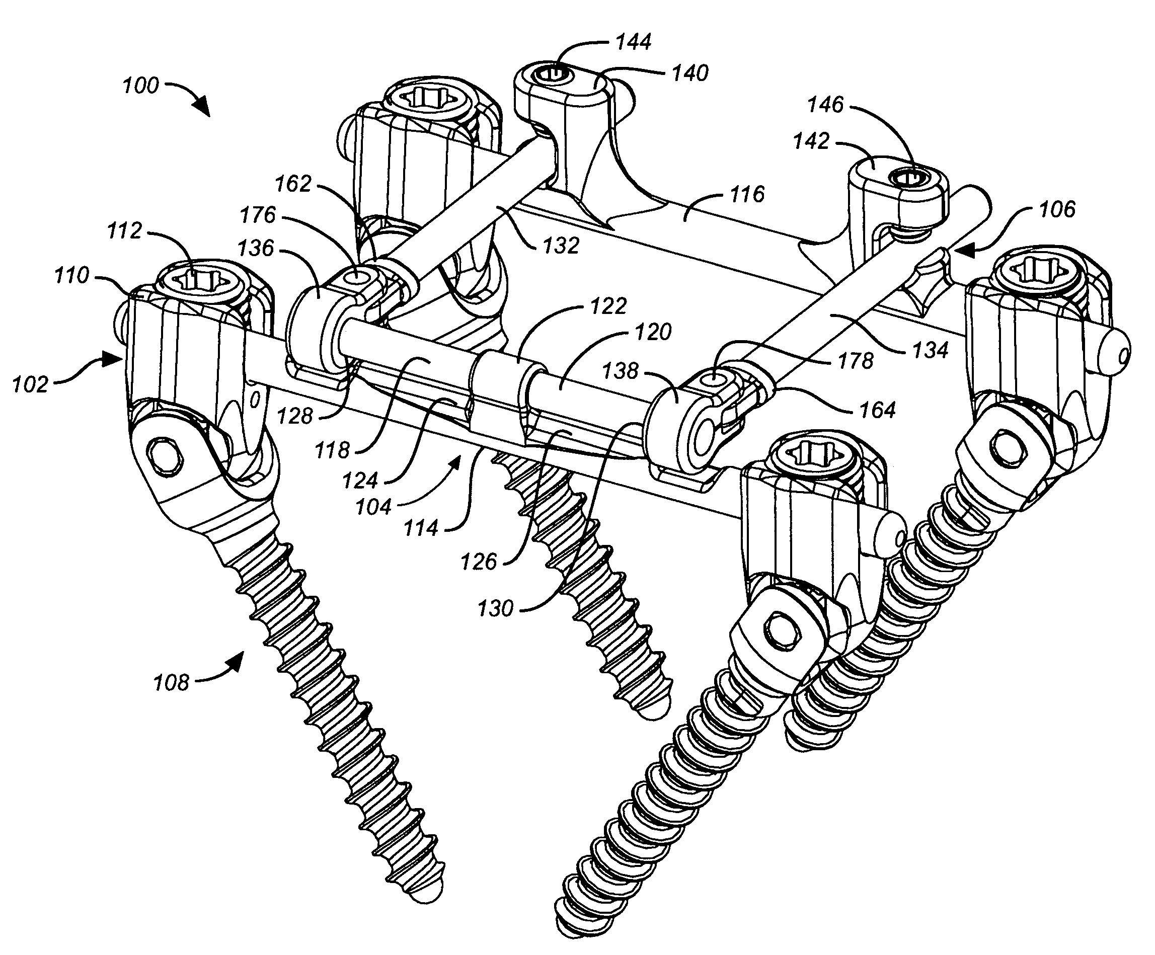 Deflection rod system for a dynamic stabilization and motion preservation spinal implantation system and method