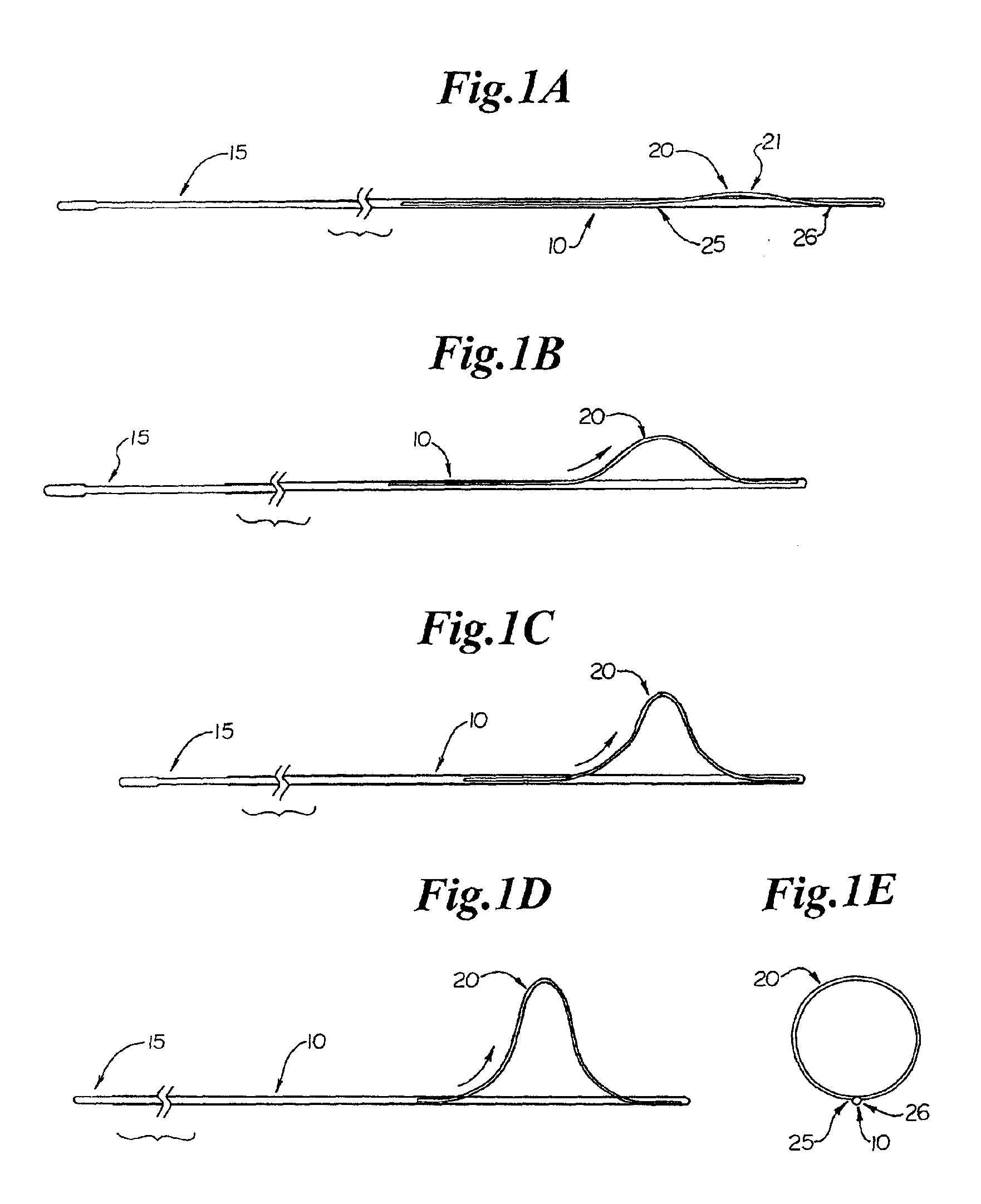 Endovascular guidewire filter and methods of use
