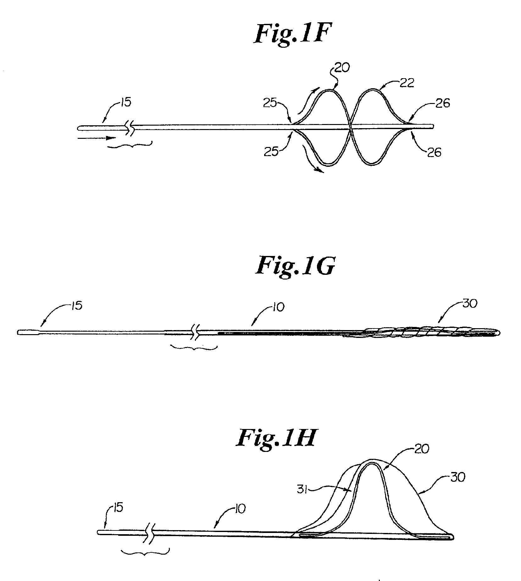 Endovascular guidewire filter and methods of use