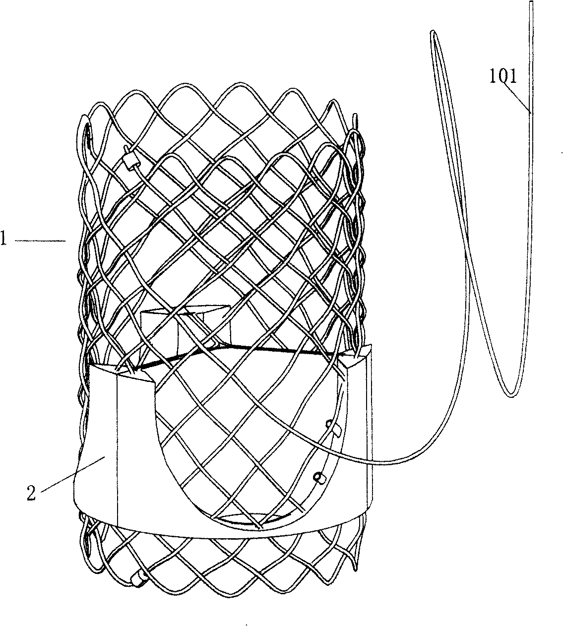 Bracket valve with bracket and biovalve knitted integrally and preparation method thereof