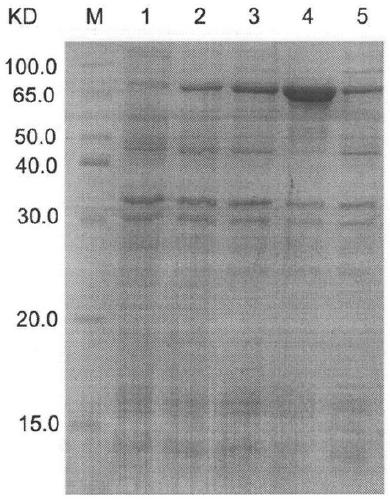 A kind of helicobacter pylori tetravalent virulence factor multi-epitope vaccine and preparation method thereof