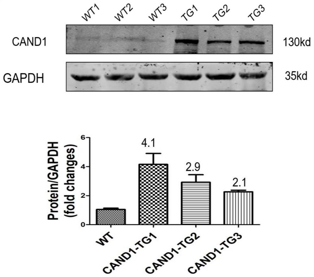 Application of CAND1 in preparation of medicine for inhibiting myocardial cell hypertrophy, heart failure and myocardial fibrosis