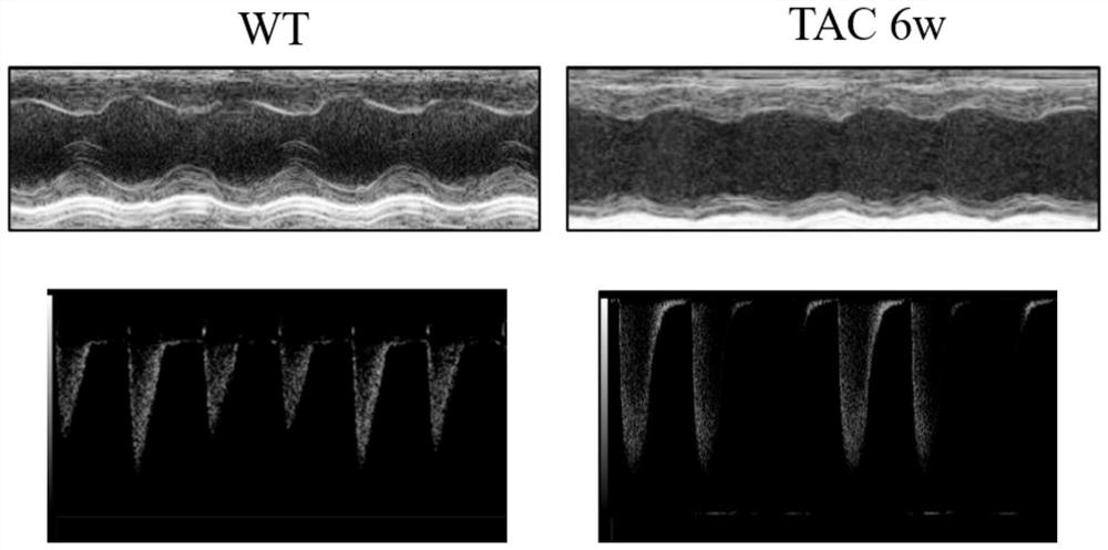 Application of CAND1 in preparation of medicine for inhibiting myocardial cell hypertrophy, heart failure and myocardial fibrosis