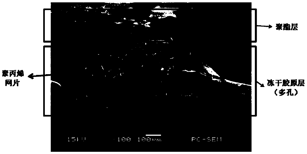 A kind of biological patch and preparation method