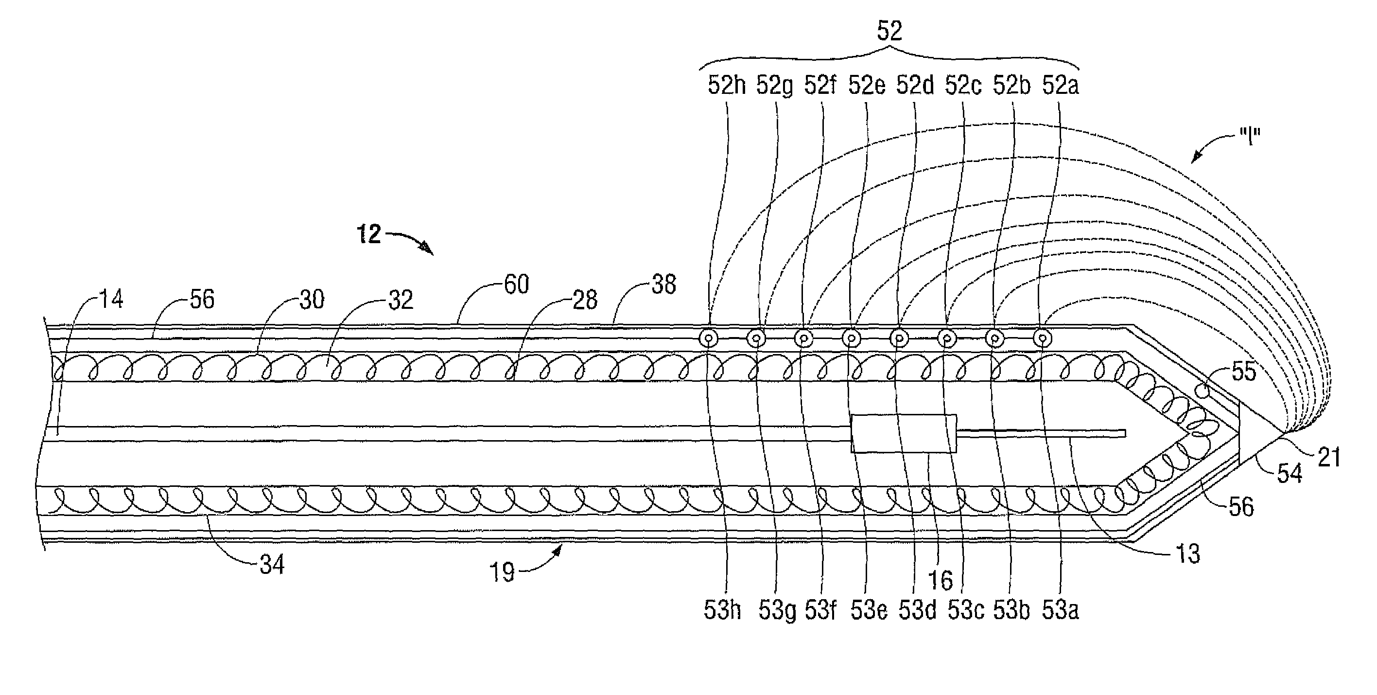 System for monitoring ablation size