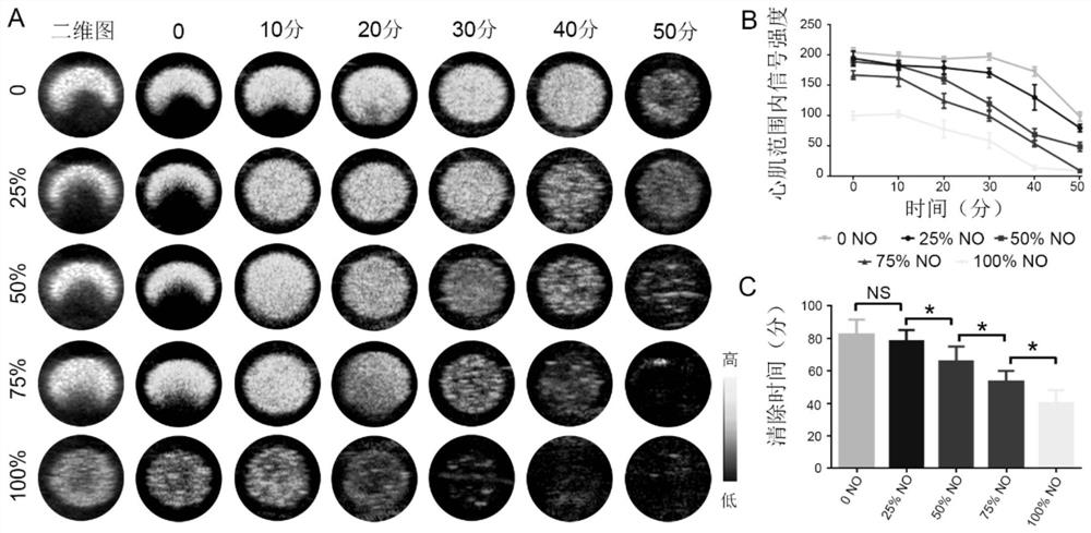 A kind of NO-loaded targeting microbubble and preparation method and application thereof