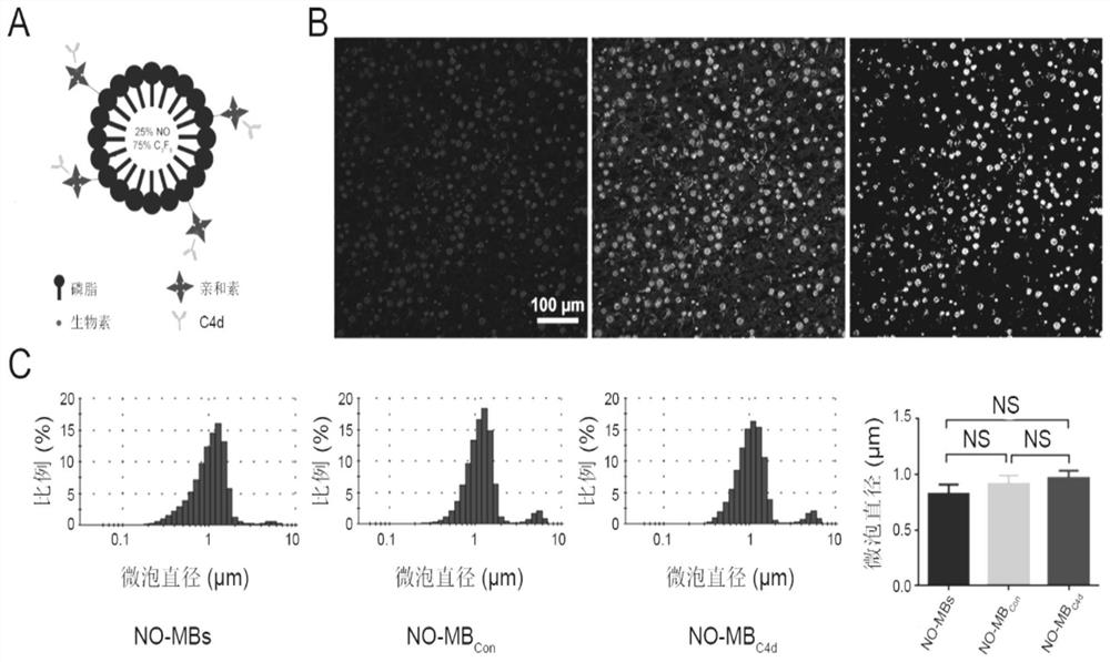 A kind of NO-loaded targeting microbubble and preparation method and application thereof