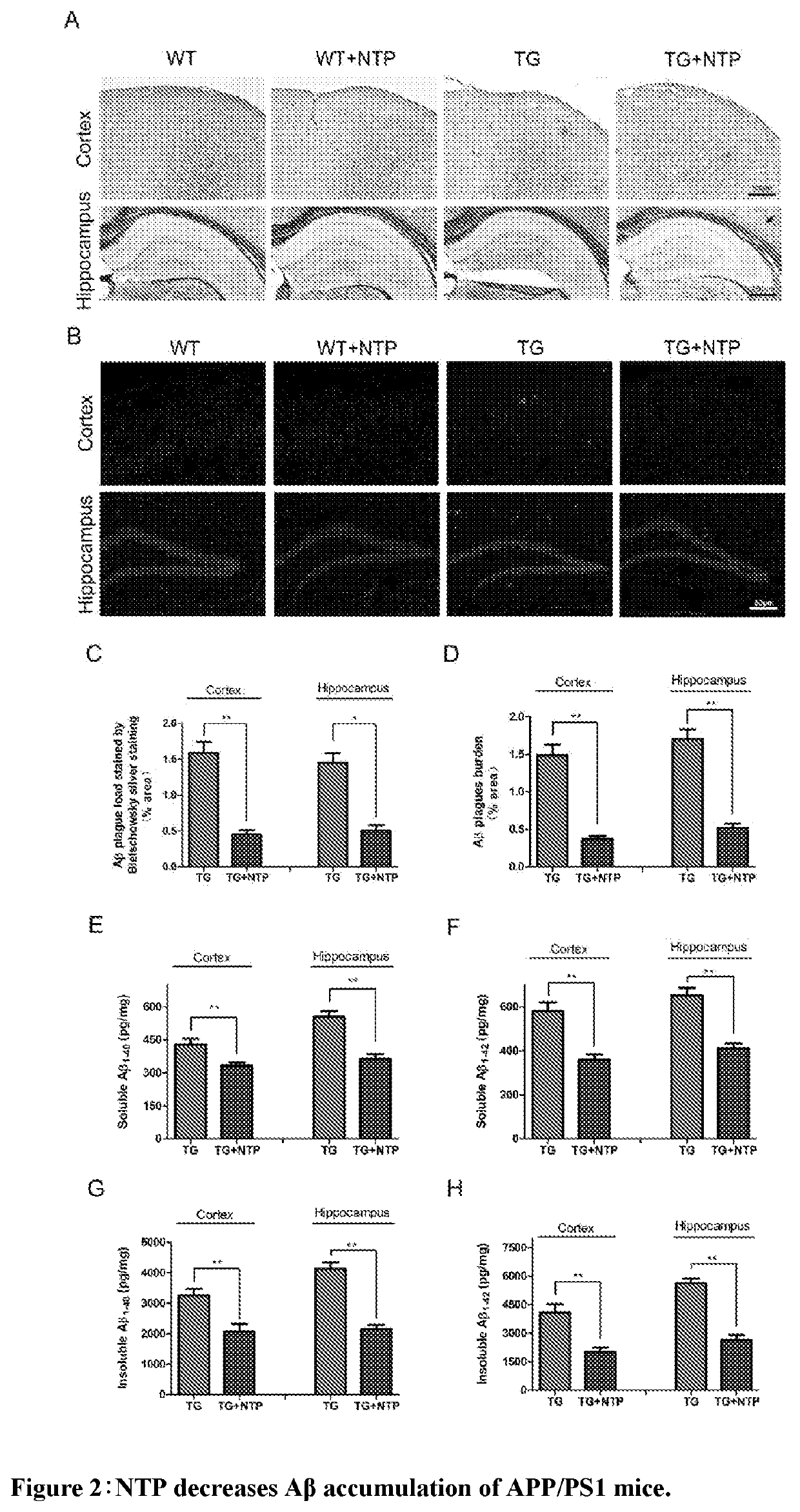 Inhibiting or alleviating agent for inflammation in the brain